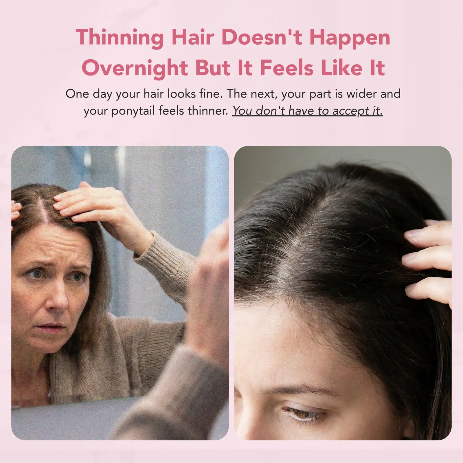 Total Hair Revival System