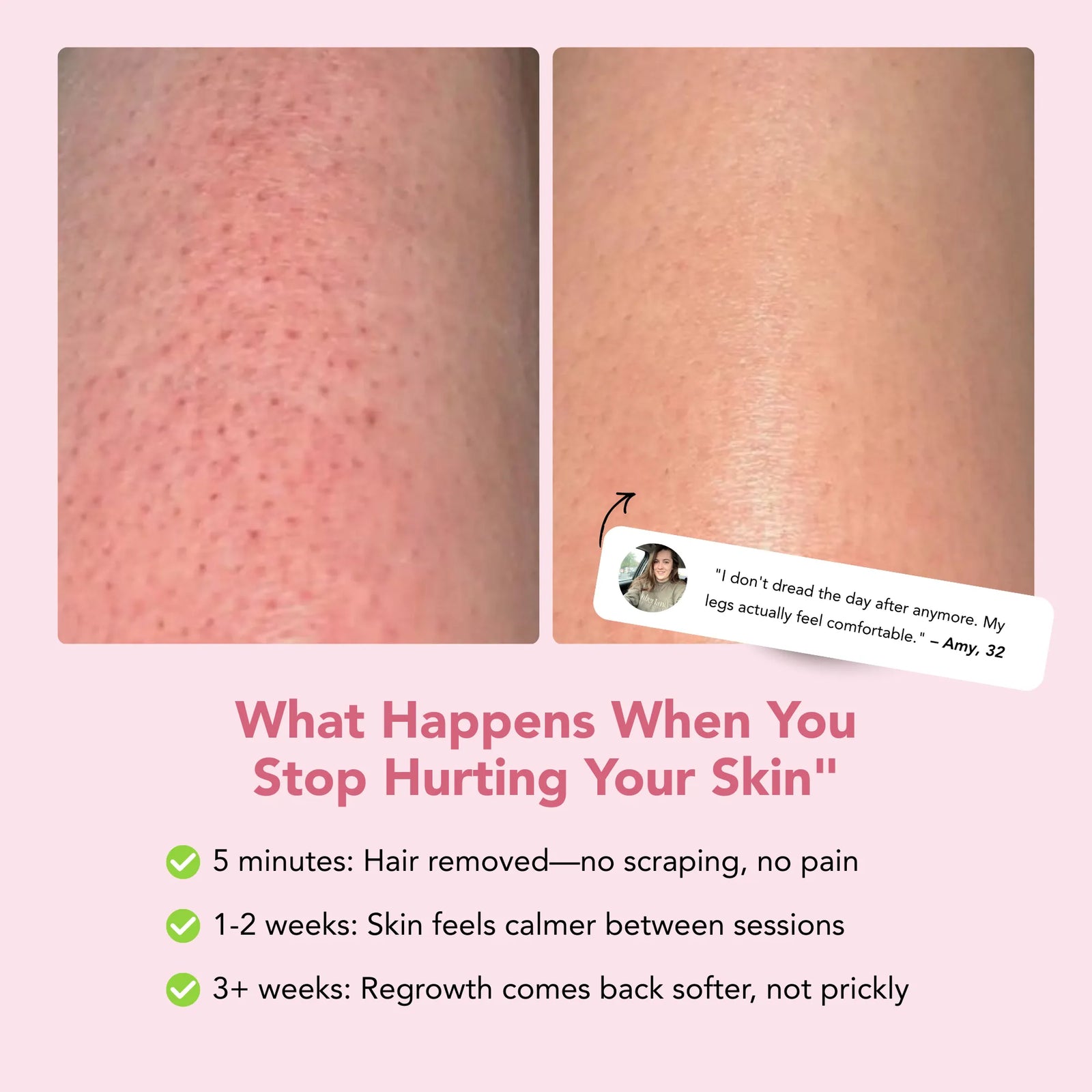 Bare Basics No Shave Hair Removal Cream