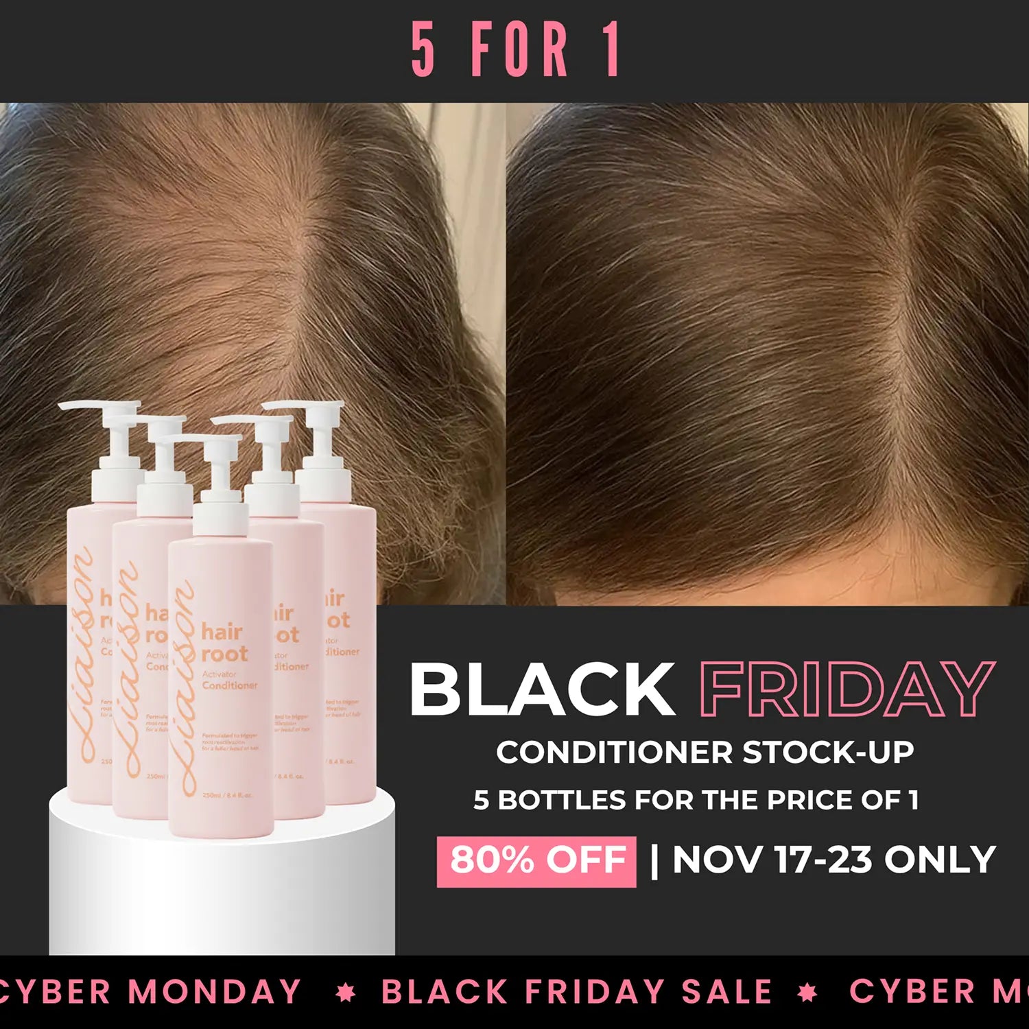Hair Root Activator Conditioner — Black Friday 5-Pack