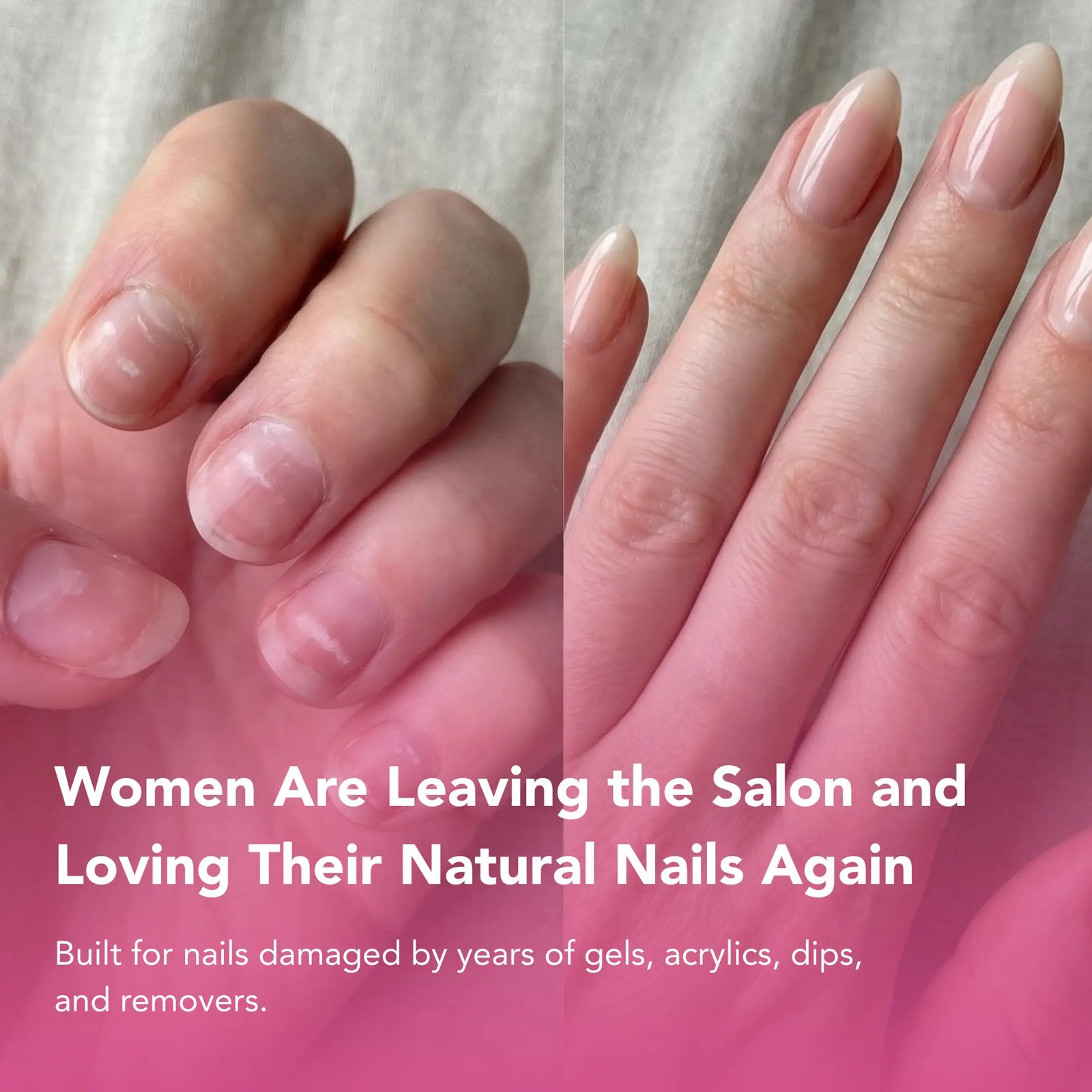 UltraGrow 2-Week Nail Revival System