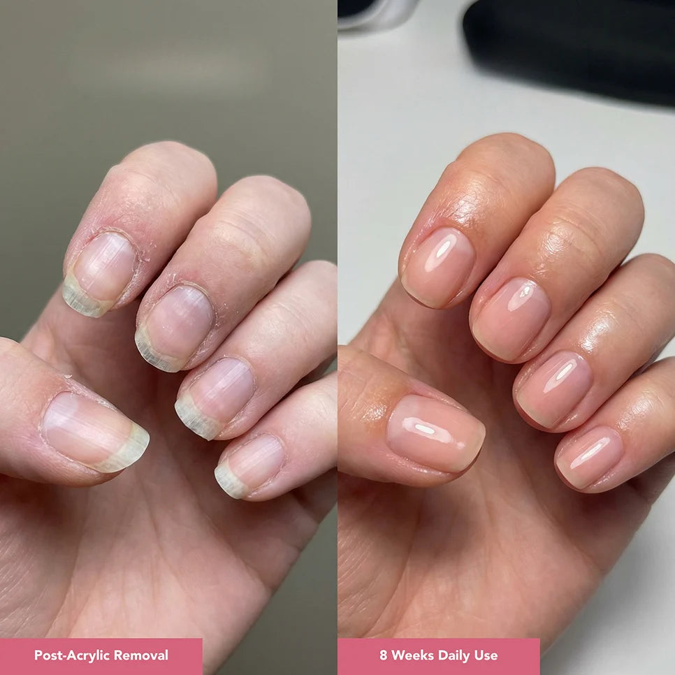 UltraGrow Nail Hydration Restoration System ($169.96 Value)