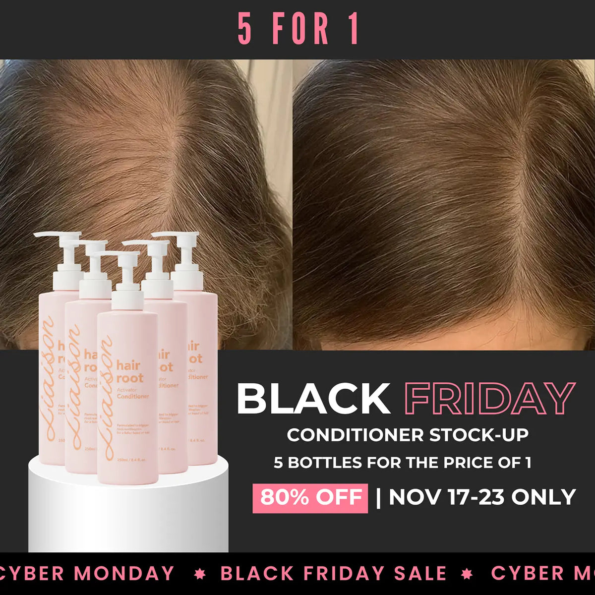 Hair Root Activator Conditioner — Black Friday 5-Pack