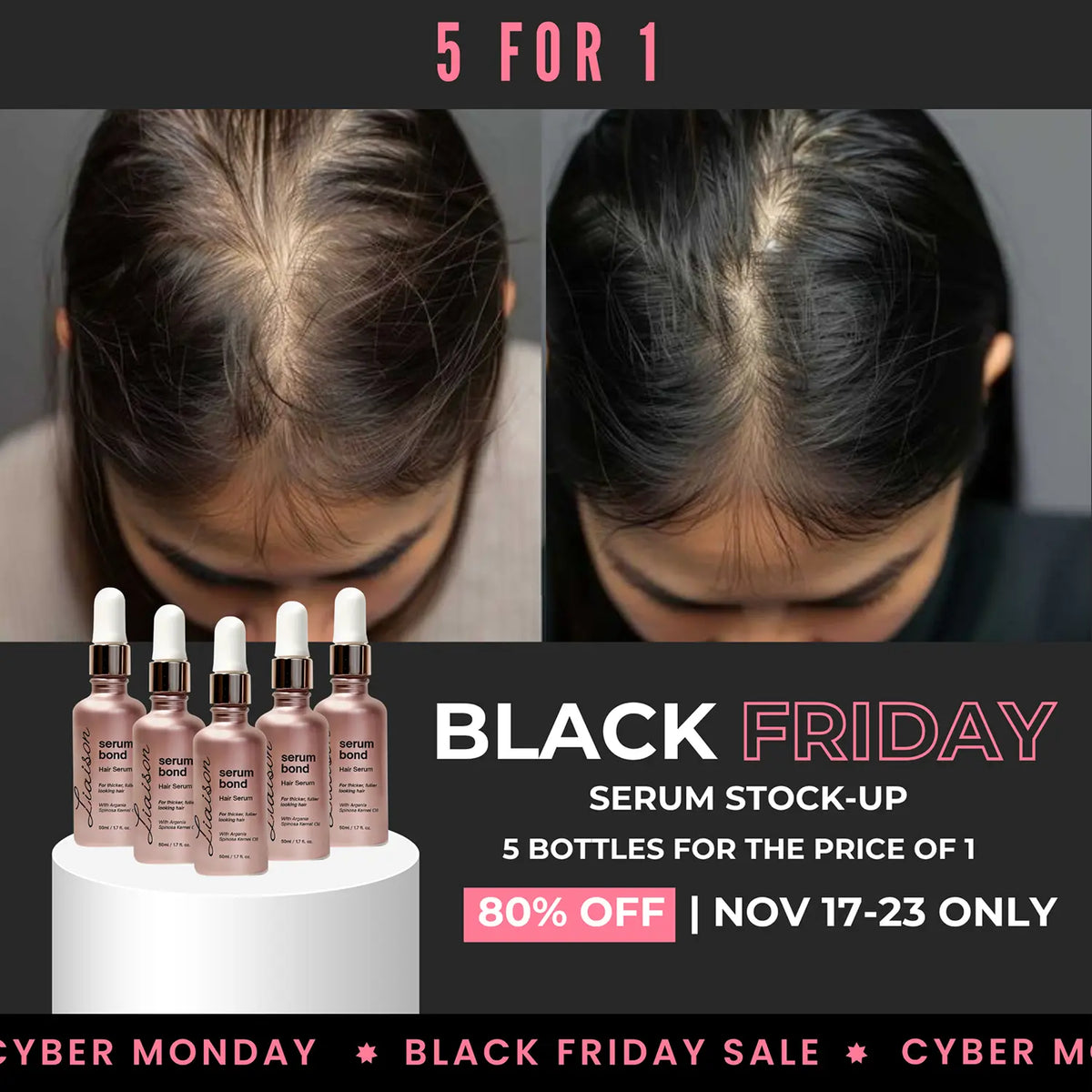 Serum Bond — Black Friday 5-Pack