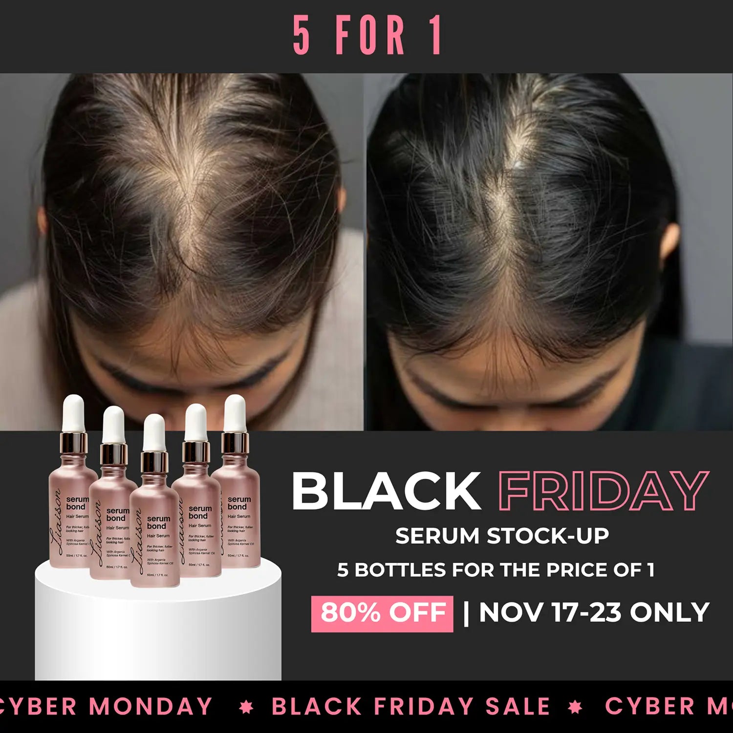 Serum Bond — Black Friday 5-Pack