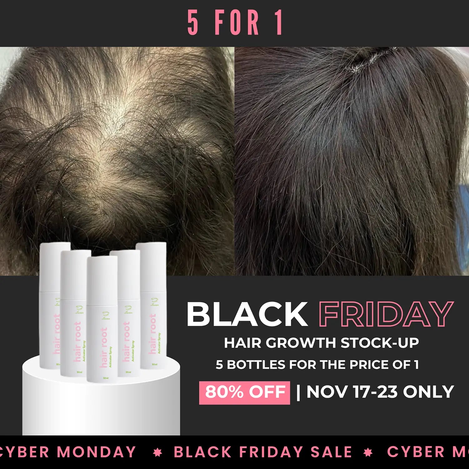 Hair Bond Spray — Black Friday 5-Pack