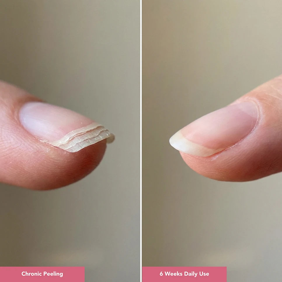 UltraGrow Nail Hydration Restoration System ($169.96 Value)