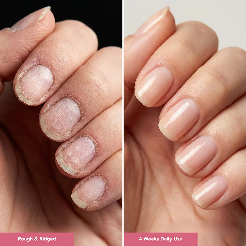 UltraGrow Nail Hydration Restoration System ($169.96 Value)