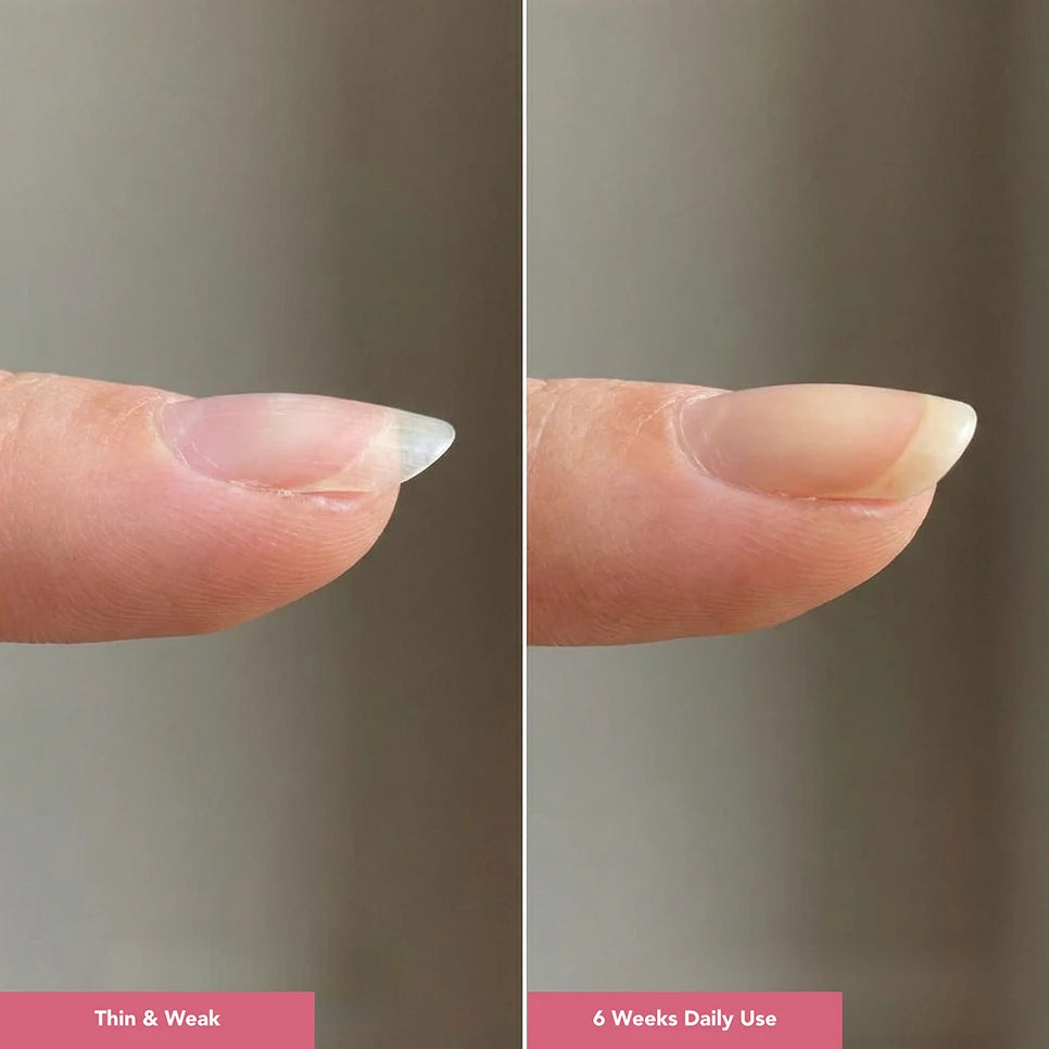 UltraGrow Nail Hydration Restoration System ($169.96 Value)