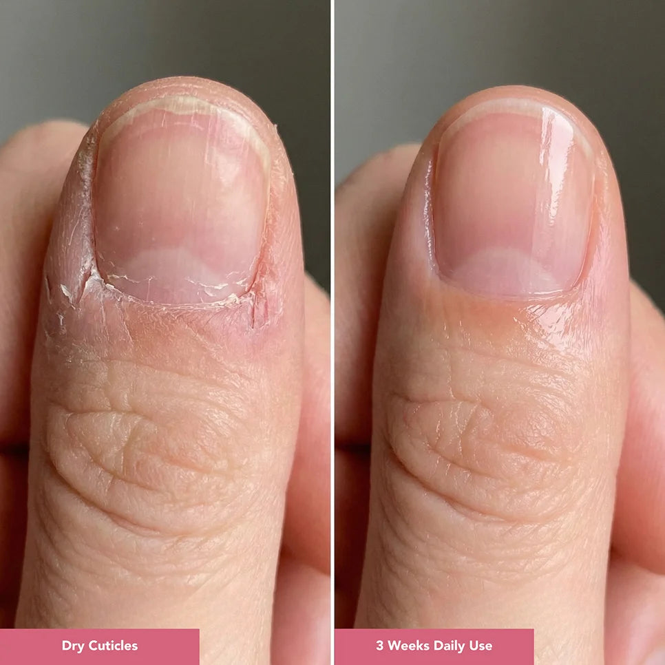 UltraGrow Nail Hydration Restoration System ($169.96 Value)