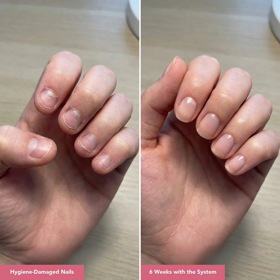 UltraGrow Nail Hydration Restoration System ($169.96 Value)