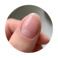 ELIMINATE PEELING & SPLITTING