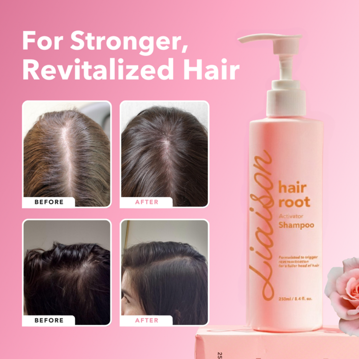 Hair Root Activator Shampoo + Conditioner Bundle