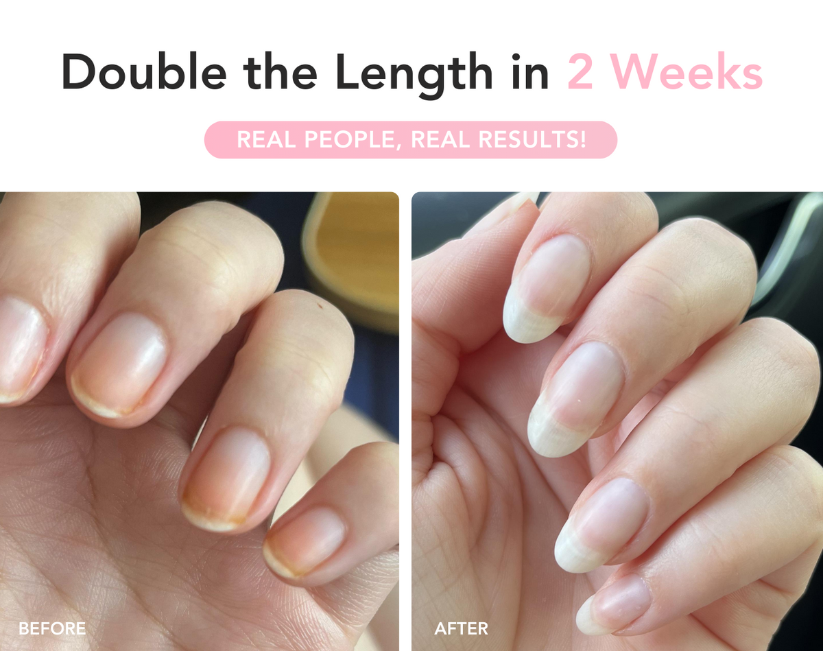 UltraGrow Nail Serum