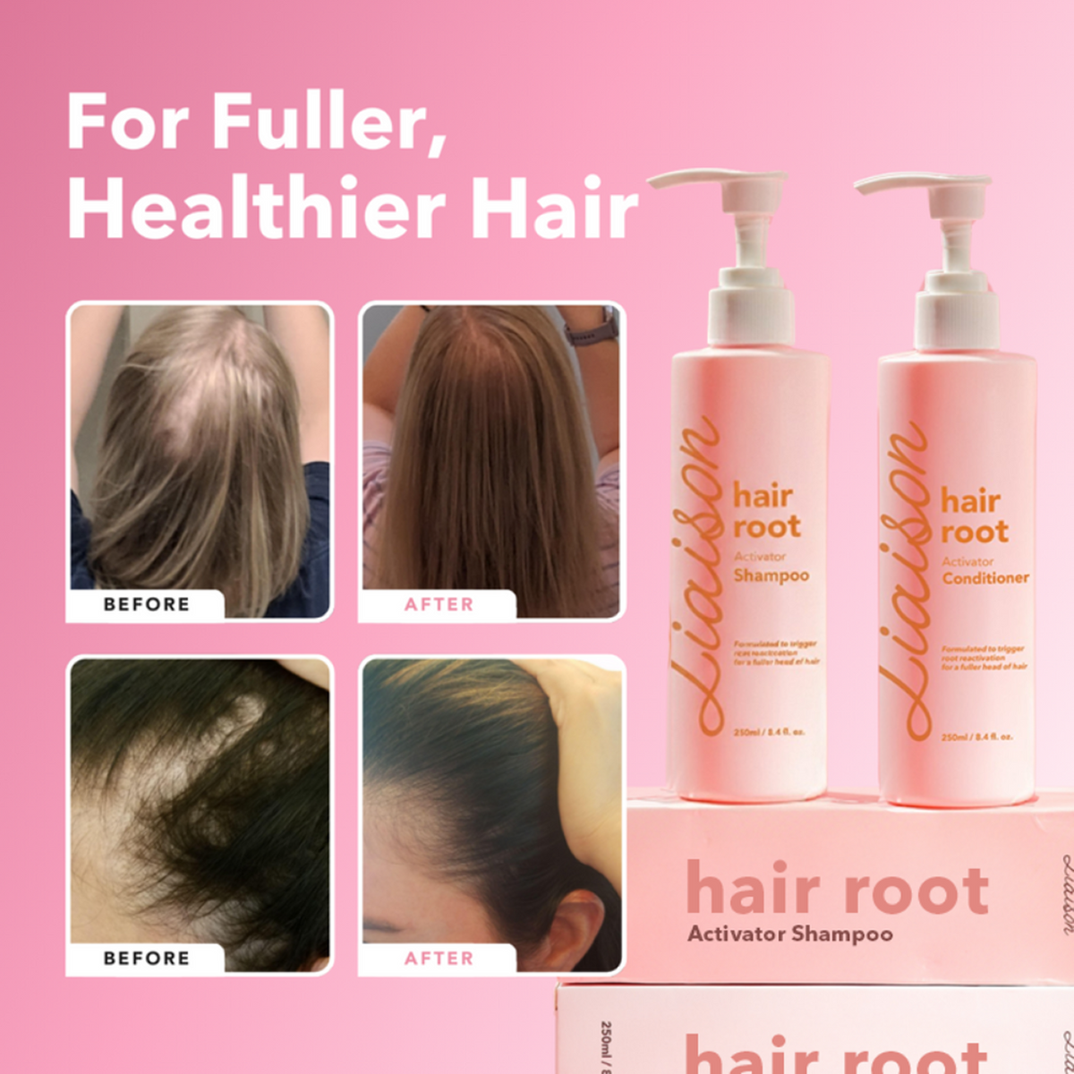 Hair Root Activator 3-Step System