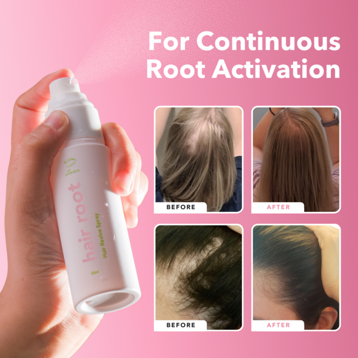 Hair Root Activator 3-Step System