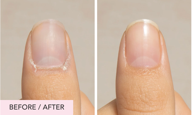 ultragrow-nail-serum-liaison-growth