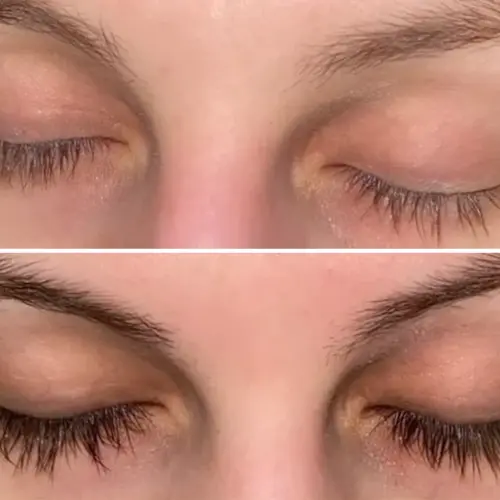 6 WEEKS APART