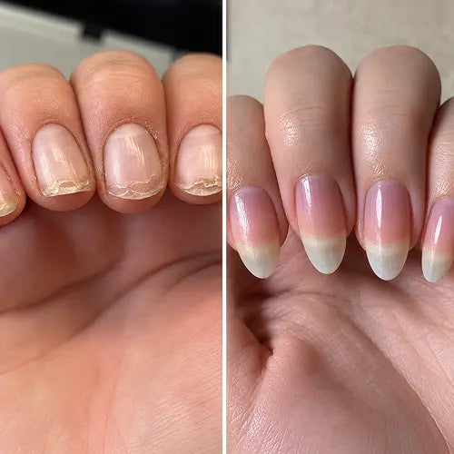 6 WEEKS APART