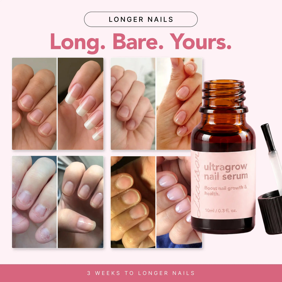 UltraGrow Nail Serum (Standard)