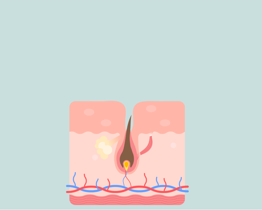 Hair Bond Shampoo Liaison Growth