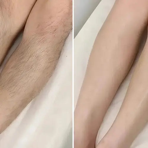 before | after — legs