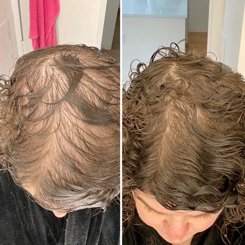 12 WEEKS APART
