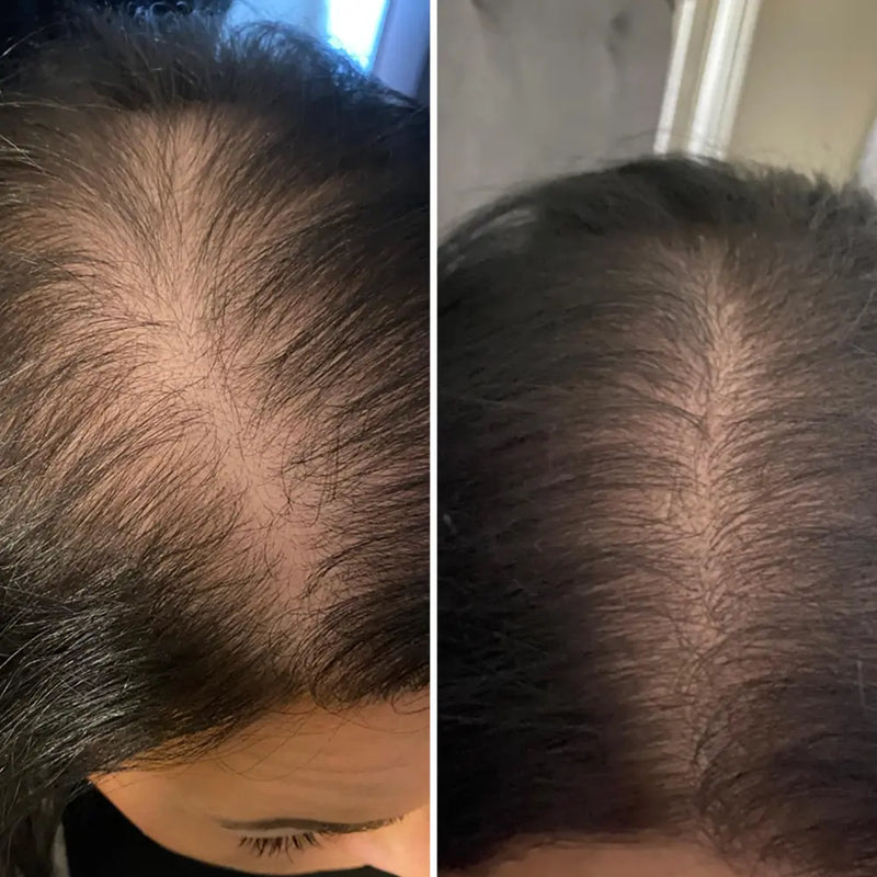 6 MONTHS APART