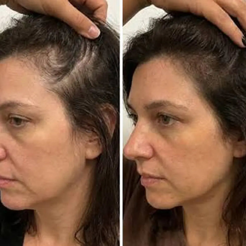 12 WEEKS APART