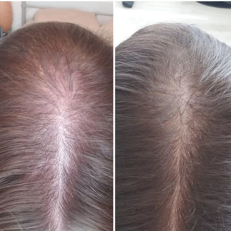6 MONTHS APART