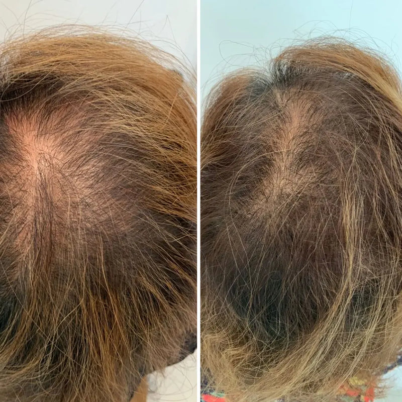 6 MONTHS APART