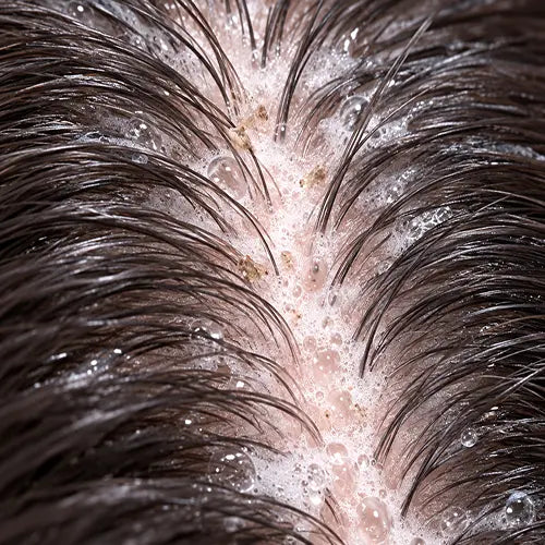 Clean scalp. Two minutes. Then it grows.
