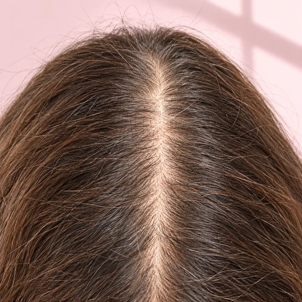 close crop, overhead, a parting in dry unstyled hair under plain window light, wider than she would like. No model's face, no bathroom, no styling. Material and cold, closer to a lab plate than a beauty shot.